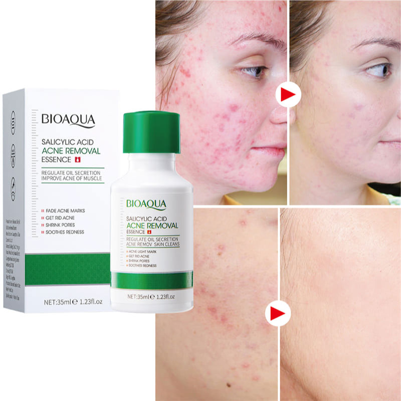 bioaqua-salicylic-acid-acne-removal-essence-3